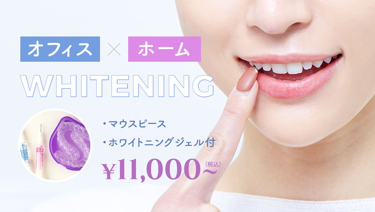ホワイトニング治療